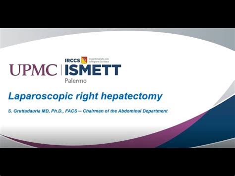 Laparoscopic Right Hepatectomy Youtube