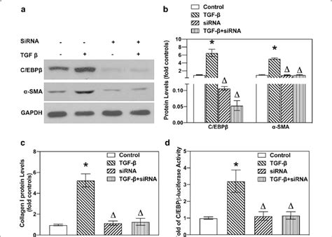 TGF β up regulated the expression of α SMA via C EBPβ activation in