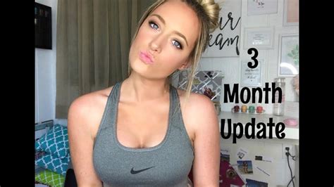 Boob Job Three Month Update YouTube