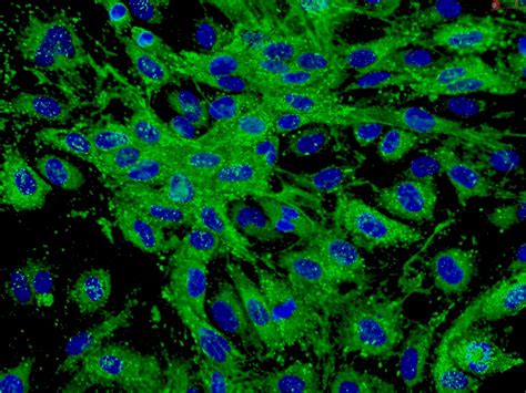 Human Dermal Microvascular Endothelial Cells HDMEC