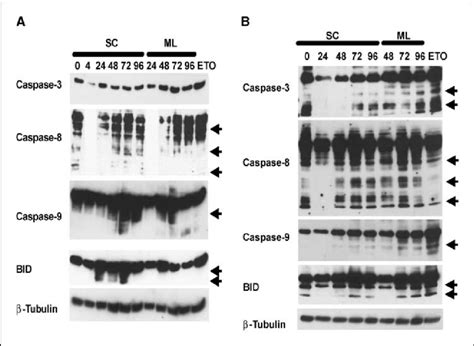 Role Of Caspase Pathways In Anoikis Western Blot Of Caspase