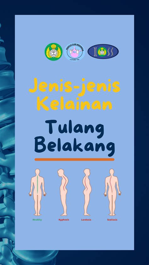 Jenis Jenis Kelainan Tulang Belakang