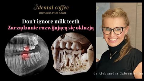 Planowanie ekstrakcji mleczaków w kontekście zgryzu Dental Coffee