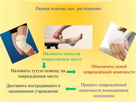 Первая помощь при растяжении связок, вывихах суставов, переломах костей ...