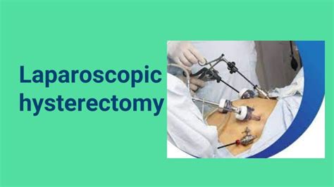 Best Gynec Laparoscopy Surgery In Bangalore Punya Hospital