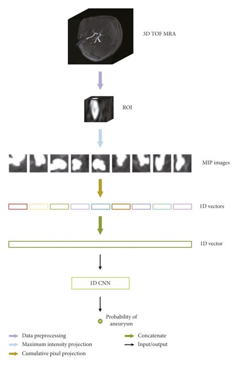 An Overview Framework For 1D CNN Based Intracranial Aneurysm Detection