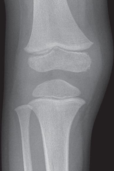 Male Knee Radiology Key