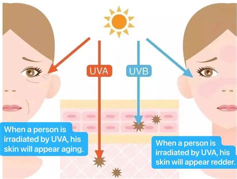 Uva Uvb And Uvc Radiation Everything You Need To Know Shenzhen