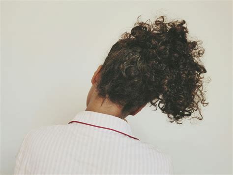 Scalp Psoriasis: Symptoms, Causes, and Treatment Tips | SELF