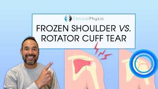 What Is The Difference Between Frozen Shoulder And Rota Doovi