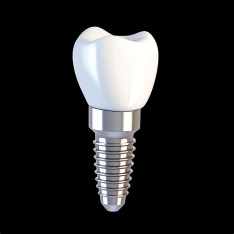 Premium Photo | A dental implant with a screw