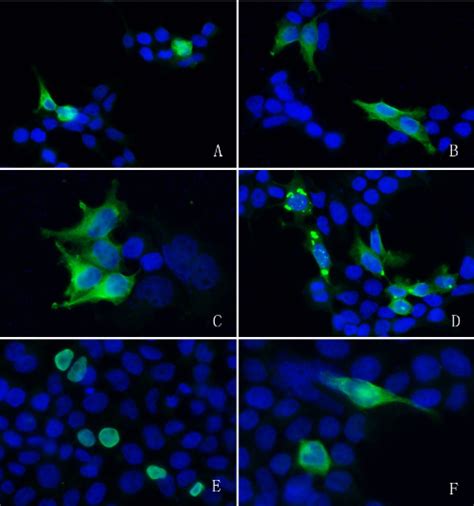 Immunofluorescence If Icc Antibody Dykddddk Tag Sino Biological