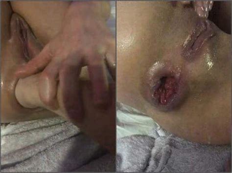 Anal Prolapse Rosebutt Large Labia Wife With Rosebutt Asshole Gets Fisted