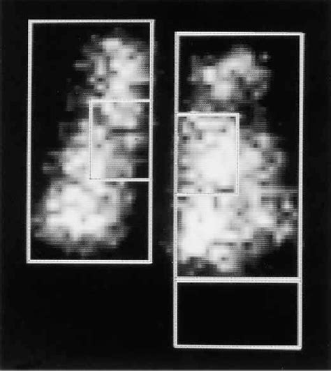 Figure From Ultrafine Particle Deposition And Clearance In The