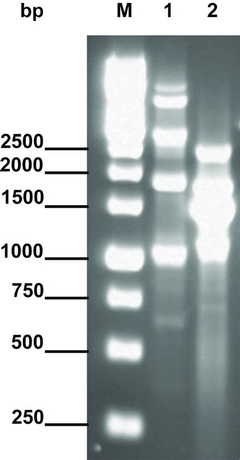 BOX PCR Electrophoretic Profiles M GeneRuler 1 Kb DNA Ladder Thermo