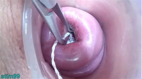 Extreme Insertion Lesbian Peehole Search XVIDEOS