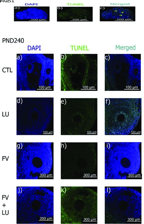 Photographs Are Representative Of Immunofluorescence Staining Of