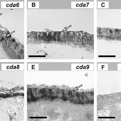 In Situ Hybridization Analysis Of Cell Type And Tissues Expressing