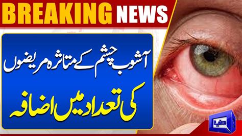 Increase In Patients Affected By Eyes Infections Dunya News Youtube