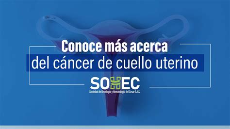 Conoce M S Acerca Del C Ncer De Cuello Uterino Sohec