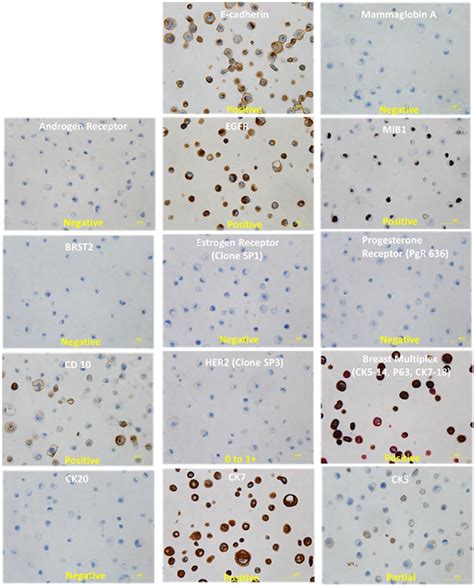 Characterization Of Immortalized Human Mammary Epithelial Cell Line