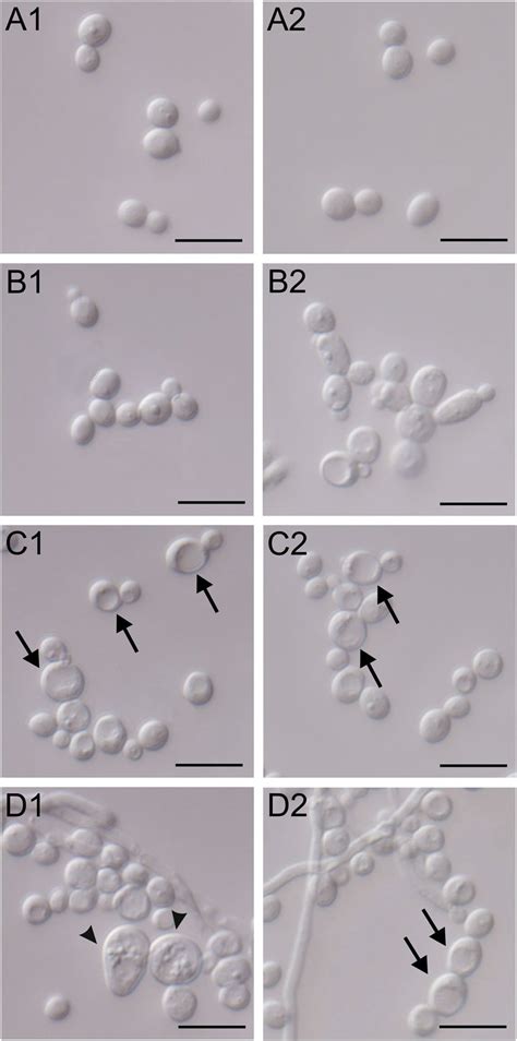 Morphological And Cell Structure Changes In C Albicans After The