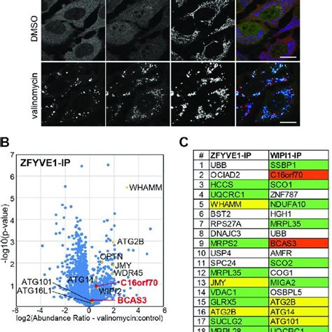 Co IP Followed By MS Analysis Of WIPI1 Associated Proteins During