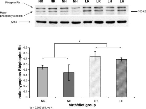 Representative Western Blot Analysis Of Rb Protein Expression In Whole