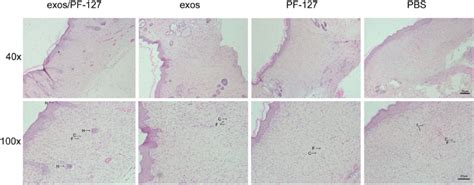 Histological Analyses Of Hematoxylin And Eosin Stained Wounds On Day 14