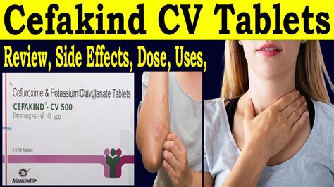 Cefakind Cv 500 Mg 250 Mg Tablet Uses In Hindi Review Cefakind