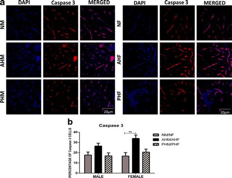 Sex Difference In Cell Death In Preconditioning Hypoxia Vs Acute