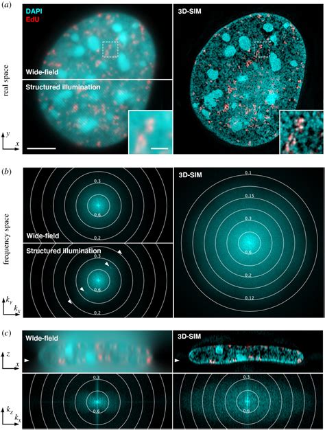 Super Resolution Structured Illumination Microscopy Past Present And