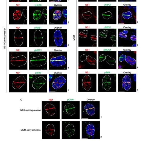 Ns1 Is A Proxy Marker For Cellular Dna Damage During Mvm Infection A