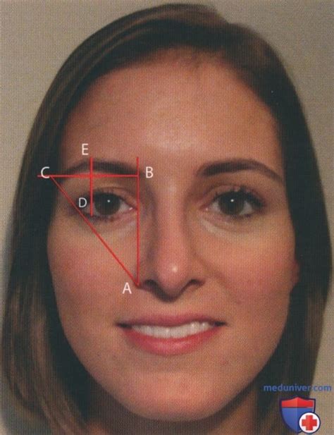 Отбор пациентов для лифтинга бровей инъекциями ботулотоксина