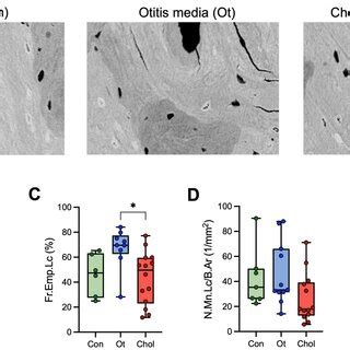 Increased Modulus Hardness Ratio As A Biomechanical Feature Of Incudes