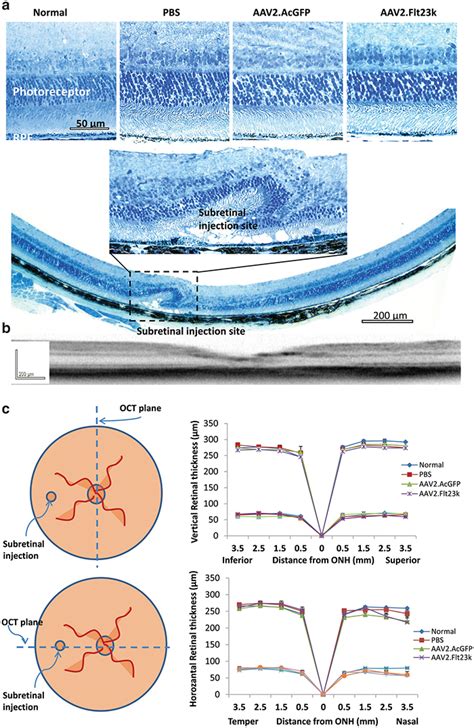 Aavflt23k Does Not Affect Retinal Thickness A Retinal Sections Of