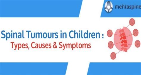 Spinal Tumours In Children Types Causes And Symptoms Mehta Spine