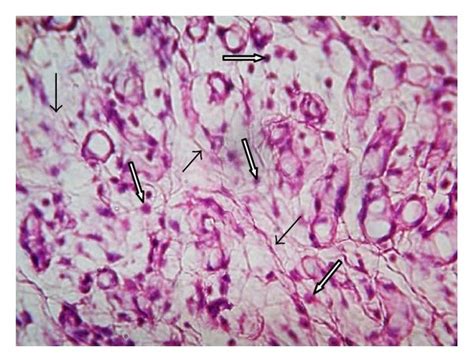 Histopathology Of Granulation Tissue At Day 10 Stained With Hande 100x Download Scientific