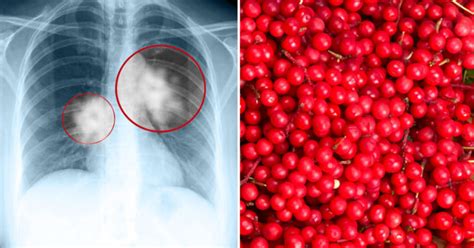 Schizandra Fruit: 10 Health Benefits - David Avocado Wolfe