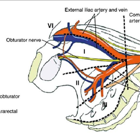 Anatomical Classification Of Pelvic Lymph Nodes Download Scientific