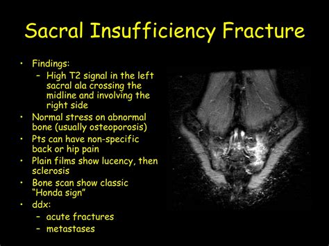 Ppt Anoxic Brain Injury Powerpoint Presentation Free Download Id 9709070