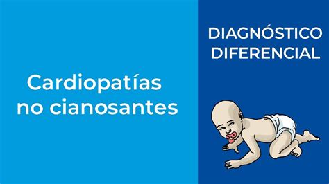 Diagnóstico Diferencial Cardiopatías no cianosantes YouTube