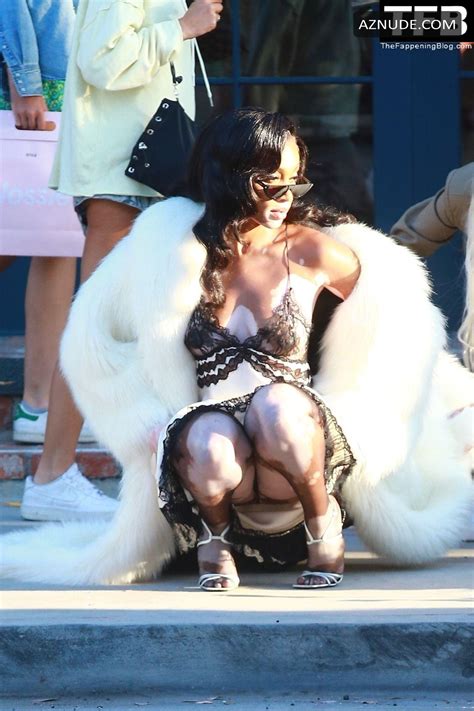 Winnie Harlow Sexy Shows Off Her Looks For Hot Lingerie Shoot In Weho Aznude