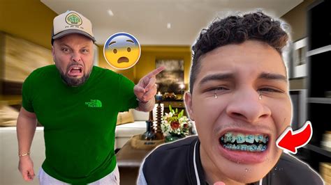 We Rushed Him To The Dentist Bad News Youtube