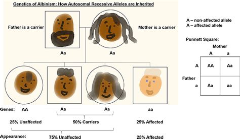 Albinism Genetics Disorder