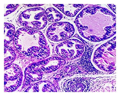 Histological Views Of Prostatic Inflammation In All Groups Normal