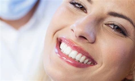 Pulizia Dei Denti E Smacchiamento Biodental Groupon