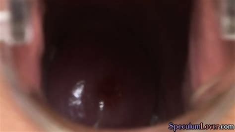 Speculum Babe Closeup Toys Pussy With Vibrator Before Gaping