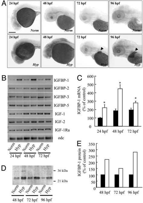 Hypoxia Induces IGFBP 1 Expression A Hypoxia Increased IGFBP 1 MRNA