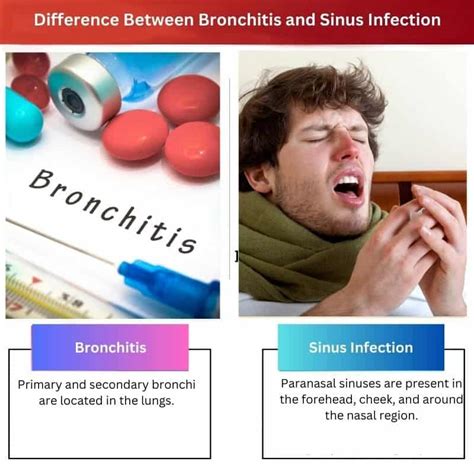 Bronquitis vs Infección Sinusal Diferencia y Comparación